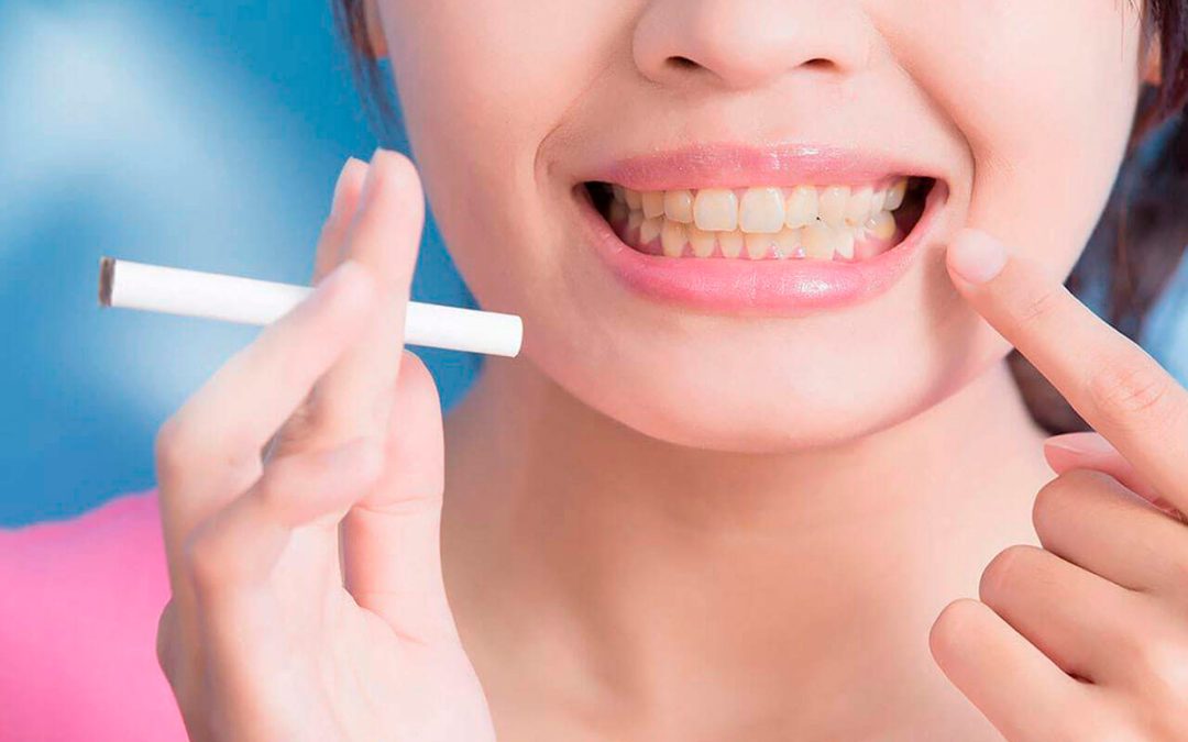 Aclarando dudas sobre los efectos del tabaco en la boca