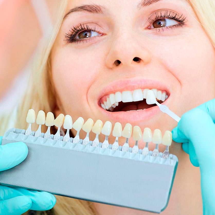 protesis-min Implante dental realizado en las Palmas
