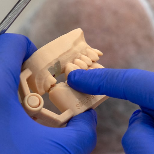 IVETTE-DIAZ-91-protesis2-min Última tecnología en los implantes dentales en las Palmas gracias a la Dr. Ivette Díaz