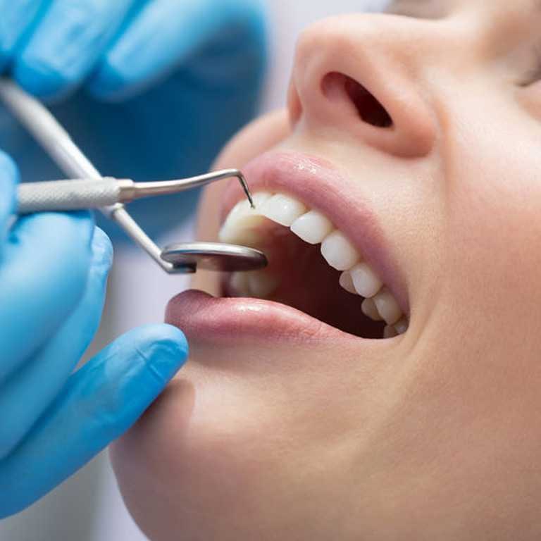 tratamiento de odontología en Las Palmas de gran canaria